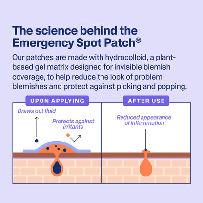 Curology Emergency Spot Pimple Patches for Face, Hydrocolloid Pimple Patches Fast-Acting, 80 Count