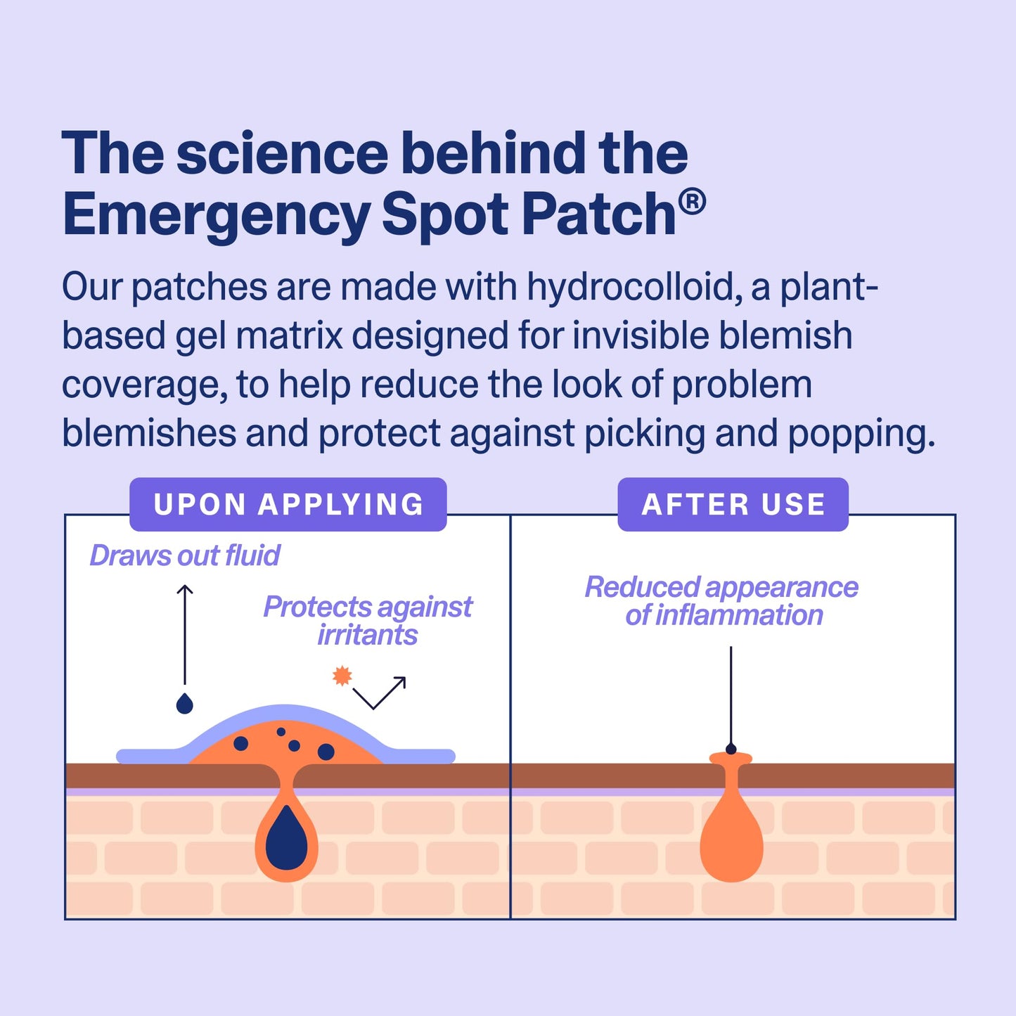Curology Emergency Spot Pimple Patches for Face, Hydrocolloid Pimple Patches Fast-Acting, 80 Count