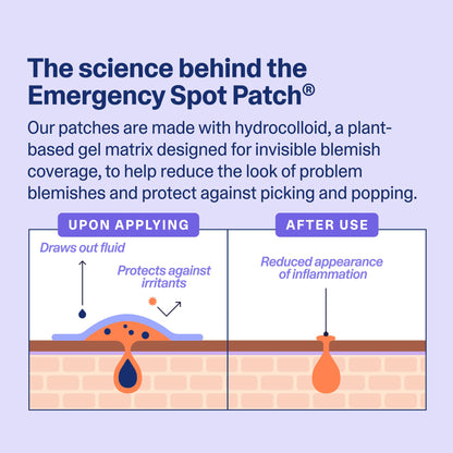 Curology Emergency Spot Pimple Patches for Face, Hydrocolloid Pimple Patches Fast-Acting, 80 Count